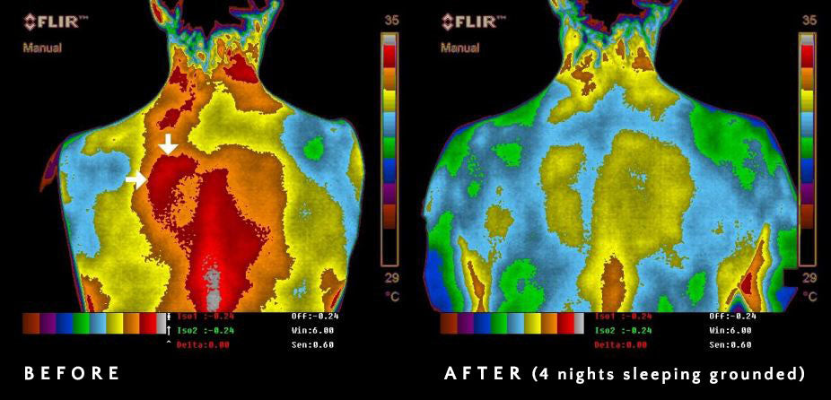 Inflammation (red) by thermography